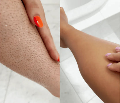 -30% Lumina IPL 9000 Laser Haarentferner